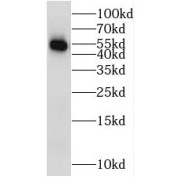 WB analysis of human kidney tissue, using STK33 antibody (1/400 dilution).