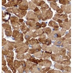 Serine/Threonine Kinase 38 Like (STK38L) Antibody