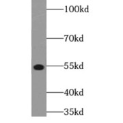 WB analysis of HepG2 cells, using STK38L antibody (1/800 dilution).