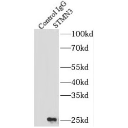Stathmin 3 (STMN3) Antibody