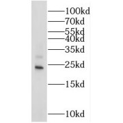 WB analysis of human brain tissue, using STMN3 antibody (1/2000 dilution).
