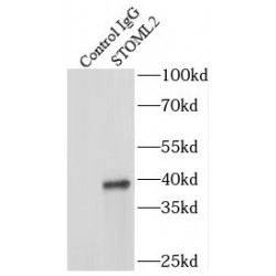 Stomatin Like 2 (STOML2) Antibody