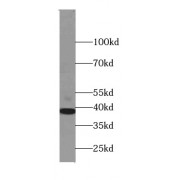 WB analysis of HepG2 cells, using STOML2 antibody (1/1000 dilution).