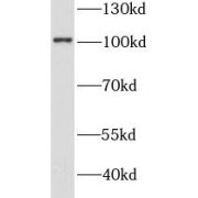 WB analysis of HEK-293 cells, using STT3A antibody (1/2000 dilution).