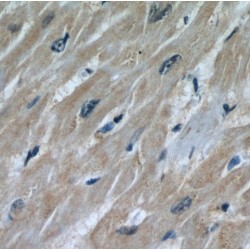 STIP1 Homology And U-Box Containing Protein 1 (STUB1) Antibody