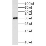 WB analysis of HeLa cells, using STUB1 antibody (1/500 dilution).