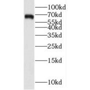 WB analysis of A375 cells, using STXBP1 antibody (1/1000 dilution).