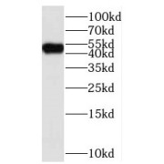 WB analysis of human brain tissue, using STYK1 antibody (1/600 dilution).