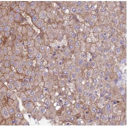 Succinate--CoA Ligase [ADP/GDP-Forming] Subunit Alpha, Mitochondrial (SUCLG1) Antibody