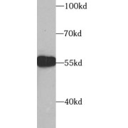 WB analysis of rat kidney, using SUFU antibody (1/1000 dilution).