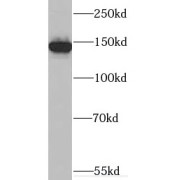 WB analysis of mouse liver tissue, using SULF2 antibody (1/500 dilution).