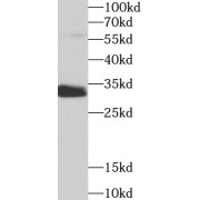 WB analysis of mouse liver tissue, using SULT1A1 antibody (1/1000 dilution).