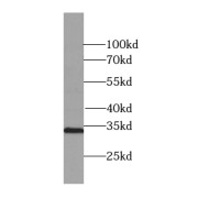 WB analysis of human placenta tissue, using SULT1A1 antibody (1/200 dilution).