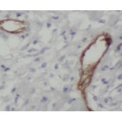 Sulfotransferase Family 1A Member 4 (SULT1A4) Antibody