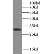 WB analysis of human colon tissue, using SULT1A4 antibody (1/300 dilution).