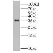 WB analysis of human colon tissue, using SULT1B1 antibody (1/600 dilution).