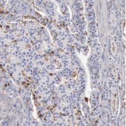 Sulfotransferase Family 1C Member 2 (SULT1C2) Antibody