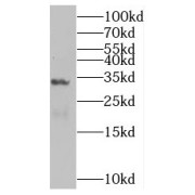 WB analysis of human stomach tissue, using SULT1C2 antibody (1/1000 dilution).