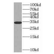 WB analysis of human lung tissue, using SULT1E1 antibody (1/500 dilution).
