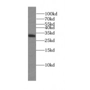 WB analysis of A431 cells, using SUMF2 antibody (1/500 dilution).