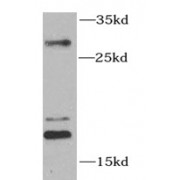 WB analysis of SW40 cells, using SUMO1 antibody (1/1000 dilution).