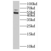 WB analysis of human liver tissue, using SUOX antibody (1/1000 dilution).