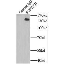 SPT16 Homolog, Facilitates Chromatin Remodeling Subunit (SUPT16H) Antibody