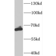 WB analysis of HeLa cells, using SUPT7L antibody (1/600 dilution).