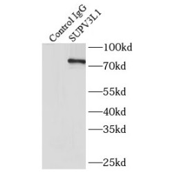 Suv3 Like RNA Helicase (SUPV3L1) Antibody