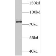 WB analysis of HeLa cells, using SUPV3L1 antibody (1/600 dilution).