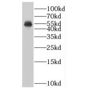 WB analysis of HepG2 cells, using SUV39H1 antibody (1/1000 dilution).