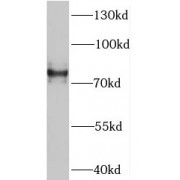 WB analysis of human brain tissue, using SV2B antibody (1/1000 dilution).