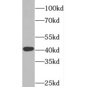 WB analysis of mouse testis tissue, using SYCE1 antibody (1/1000 dilution).