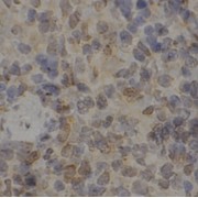 IHC-P analysis of human spleen tissue, using SYK Antibody (1/50 dilution).