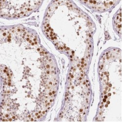 Symplekin (SYMPK) Antibody