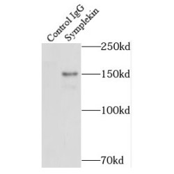 Symplekin (SYMPK) Antibody