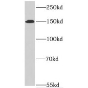 WB analysis of K-562 cells, using Symplekin antibody (1/500 dilution).