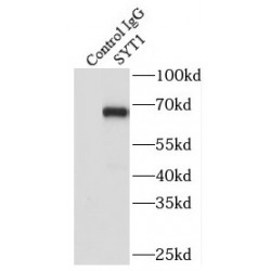 Synaptotagmin-1 (Syt1) Antibody