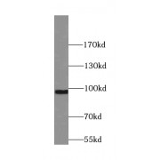 WB analysis of mouse skeletal muscle tissue, using Synaptotagmin-11 antibody (1/300 dilution).