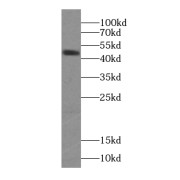 WB analysis of human brain tissue, using SYT4 antibody (1/400 dilution).