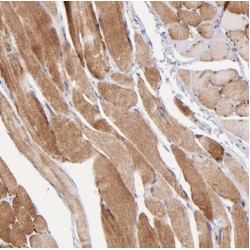 Syncoilin (SYNC) Antibody