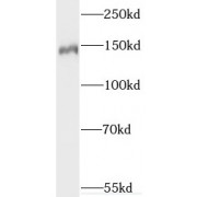 WB analysis of mouse brain tissue, using SYNGAP1 antibody (1/500 dilution).