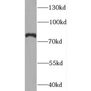 WB analysis of mouse testis tissue, using SYNPO2L antibody (1/300 dilution).