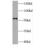 WB analysis of mouse trachea tissue, using Syntaphilin antibody (1/800 dilution).