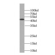 WB analysis of human kidney tissue, using STX16 antibody (1/500 dilution).