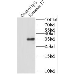 Syntaxin 17 (STX17) Antibody