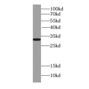 WB analysis of L02 cells, using STX17 antibody (1/1000 dilution).