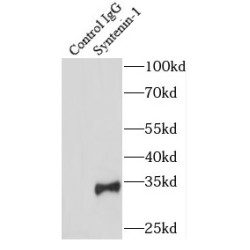 Syntenin-1 (SDCBP) Antibody