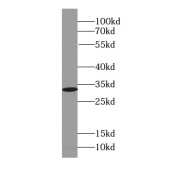 WB analysis of HepG2 cells, using SDCBP antibody (1/1000 dilution).