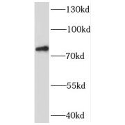 WB analysis of human kidney tissue, using SYT17 antibody (1/800 dilution).